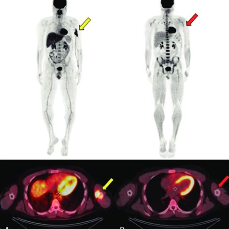 Mesmo Paciente Das Figuras E Imagens Axiais De Rm Ponderadas Em T