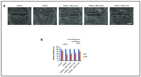 αBC P inhibits TGFβ2 induced hRPE cell migration Representative images