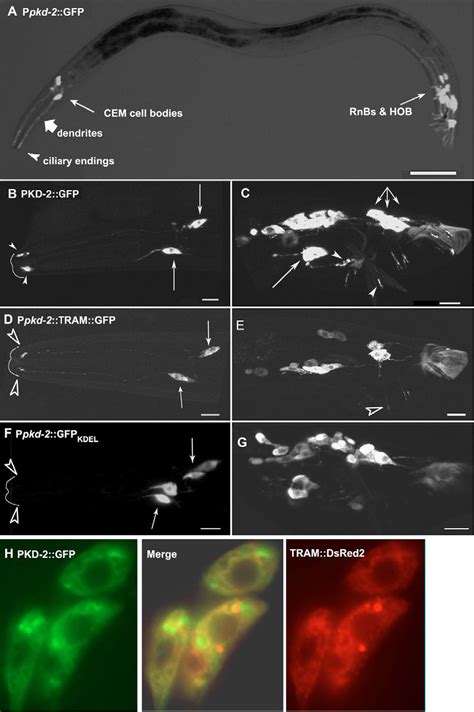 Figure 1 From General And Cell Type Specific Mechanisms Target TRPP2