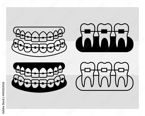 Fake Braces, Fake Braces Kit, Fake Braces Clip On, Braces Svg, Dental ...