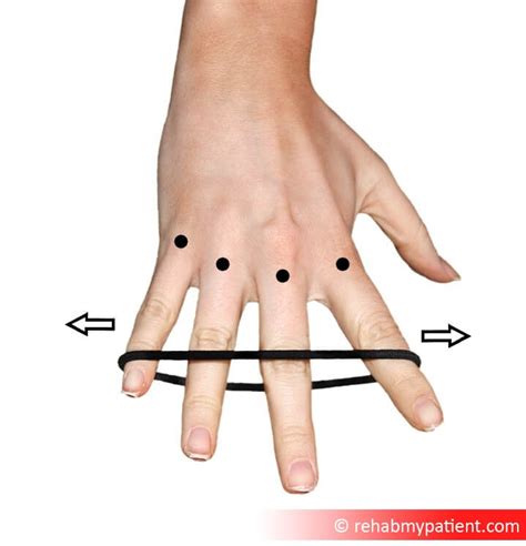 Flexor Tendon Injuries | Rehab My Patient