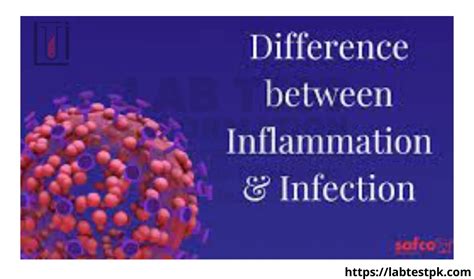 Infection and Inflammation