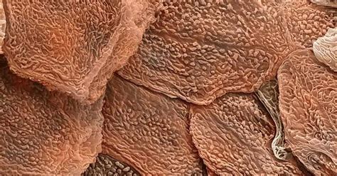 Human Skin Under An Electron Microscope Album On Imgur