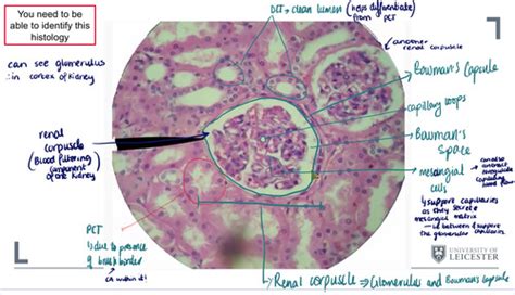 glomerulonephritis and histology of glomerulus Flashcards | Quizlet