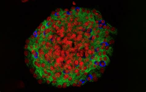 Cloaking insulin-producing cells to evade the immune system | Medicine ...