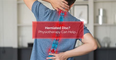 Herniated Disc? Physiotherapy Can Help… | Physiomed