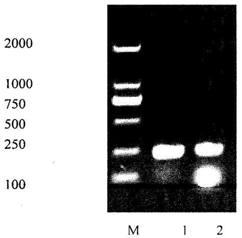 Toxoplasma Circulating Antigen Double Antibody Sandwich Elisa Enzyme