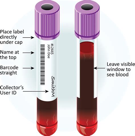 Fundamental Principle Of Clinical Specimen Collection Microbiology Notes