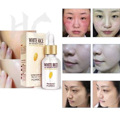 Rorec White Rice Serum Reduces Wrinkles Dark Spots Essence Moisturizing