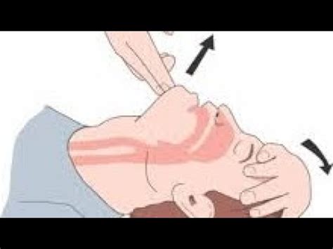 Head Tilt Chin Lift Maneuver Dr Muhammad YouTube