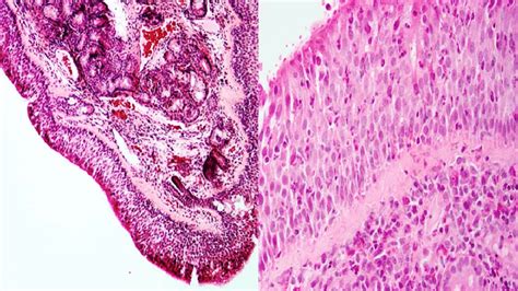 Histology Of Nasal Epithelium Hande Staining Left Light Microscopy