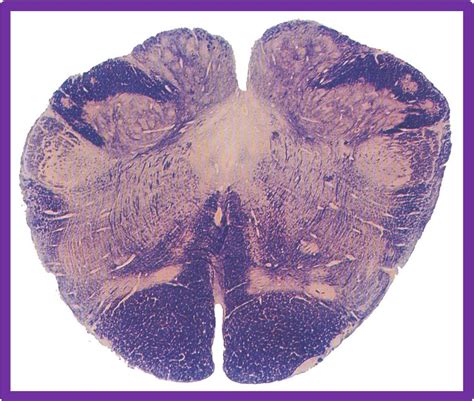 Caudal Medulla And The Nuclei Diagram Quizlet