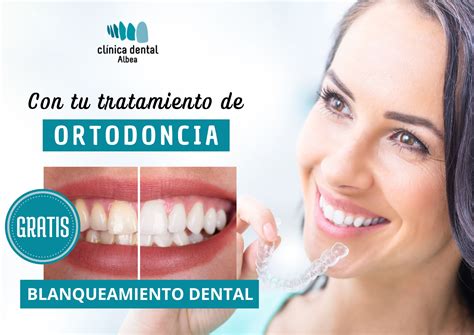 Sonrisa Perfecta Y Radiante Ortodoncia Blanqueamiento Dental GRATIS