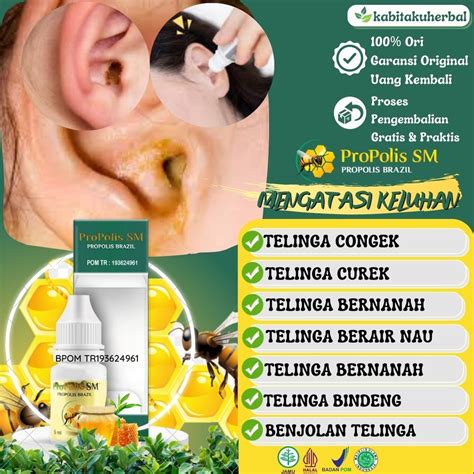 Jual Obat Tetes Telinga Congek Curek Bernanah Berair Bau Berdarah