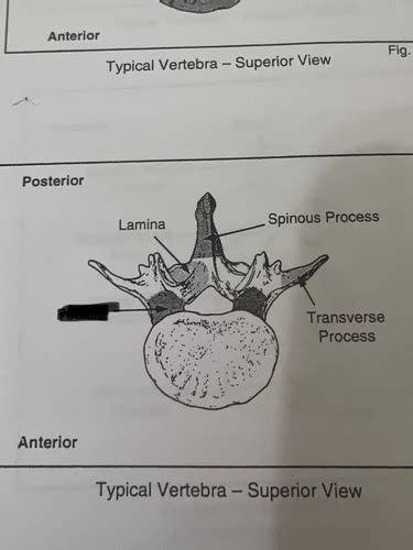 C T Spine Test Flashcards Quizlet