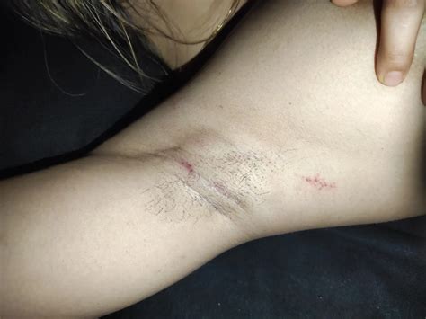 My Armpits Nude Pics XHamster