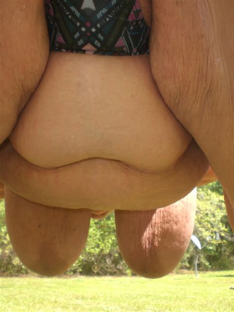 Fat Flabby BBW Wife Outside Sunbathing Mini Bottle Insertion Porn Pictures XXX Photos Sex