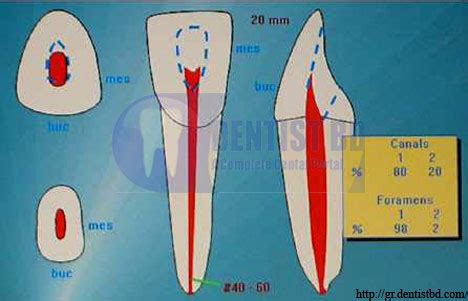 HU TU TU: mandibular central incisor