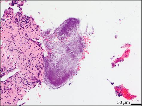 Histology of a representative tissue fragment with clearly visible bone... | Download Scientific ...