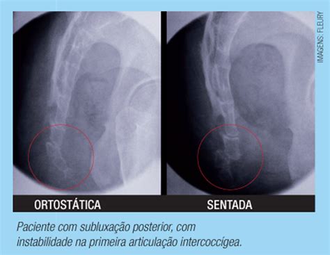 Após A Obtenção Destas Imagens é Possível Verificar Os Seguintes Parâmetros ângulos