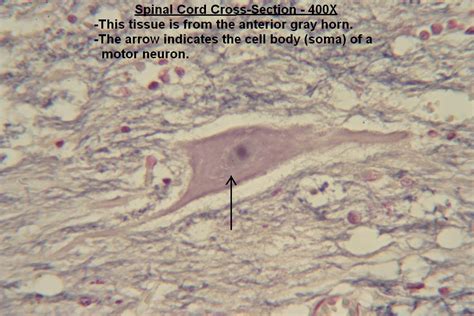 I – Spinal Cord X-Section – Gray Matter 400X 1