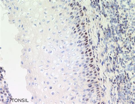 E4F1 Mouse Monoclonal Clone 272G EuroMAbNet