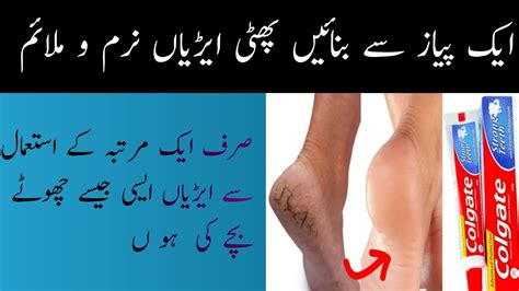 Crack Heel Remedy Phati Ariyan Ka Ilaj Youtube