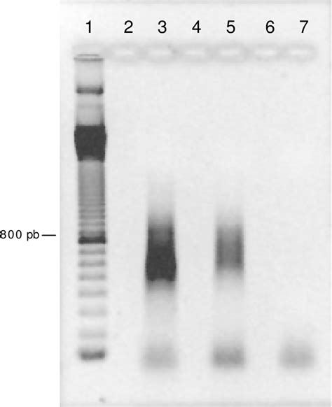 Electroforesis En Gel De Agarosa Al 1 De Alícuotas De Adnc De Ovocitos Download Scientific