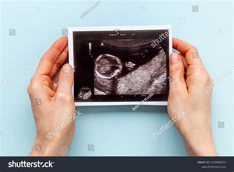 Womans Hands Holding Ultrasound Scan Unborn Stock Photo 2149908257 ...