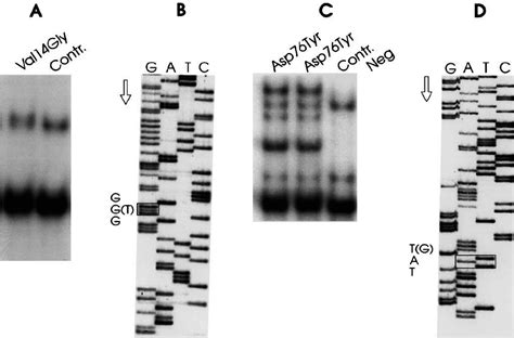 Pcr Sscp And Dna Sequence Analysis Of Samples From Patients With The