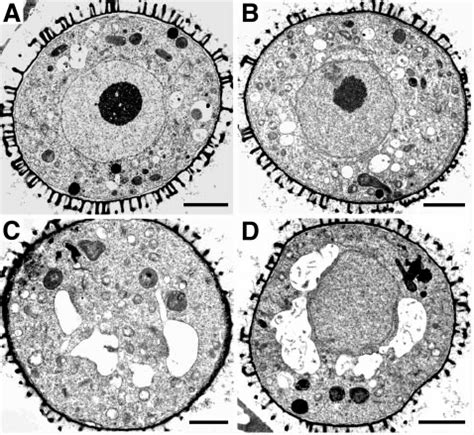 Transmission Electron Micrographs Of Wild Type No O A And C And