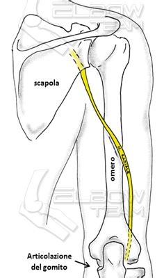 Sindrome Da Compressione Del Nervo Radiale Il Gomito