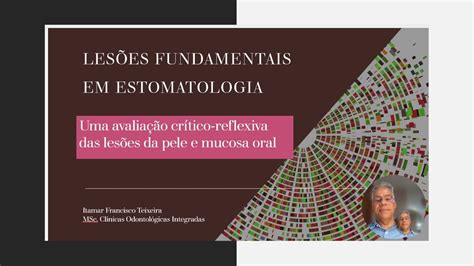 Aula Lesões Fundamentais em Estomatologia YouTube