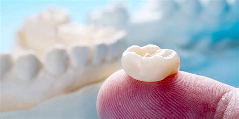 Pros And Cons Of Dental Crowns