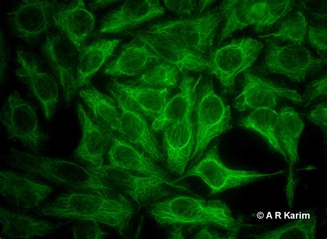 Hep 2 Cytoplasmic Fibres University Of Birmingham