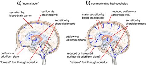 View Of Net Csf Flow Pattern In Normal Adult Brain Compared With That