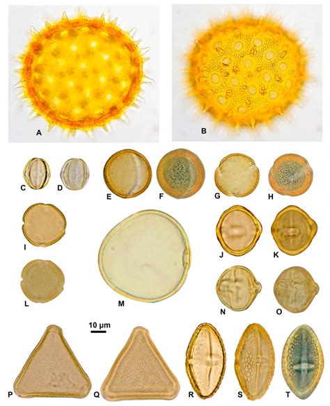 Micrograf As En Microscopio Ptico Del Polen Recuperado En Las Muestras