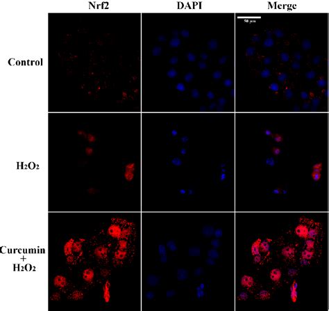 Figure 6 From Curcumin Protects Human Trophoblast Htr8svneo Cells From