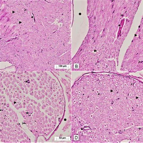 A Hematoxylin Eosin Staining Of The Sciatic Nerve Section In The