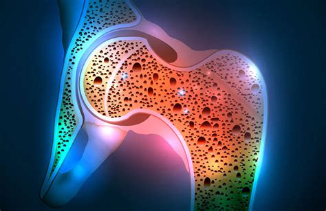 Densitometria Ossea Analisi Mediche Pavanello