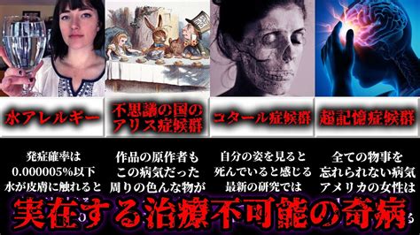 【治療不可】実在する世界の怖すぎる奇病4選 Youtube