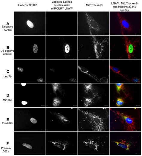 In Situ Hybridization Pattern Of Digoxigenin Labeled Locked Nucleic