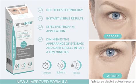 Remescar New And Improved Eye Bags Dark Circles Cream For Under