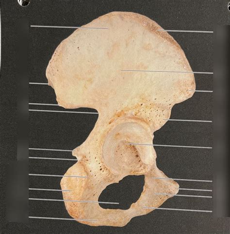 Right Coxal Hip Bone Lateral View Diagram Quizlet