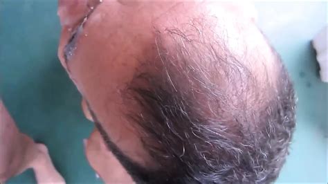 Free Bears Orgy Gay Porn Videos Xhamster