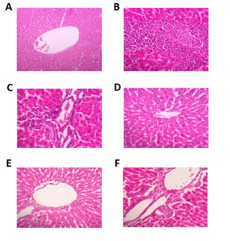 Histopathologic Results Of Rat Liver In The Groups A Histology Of