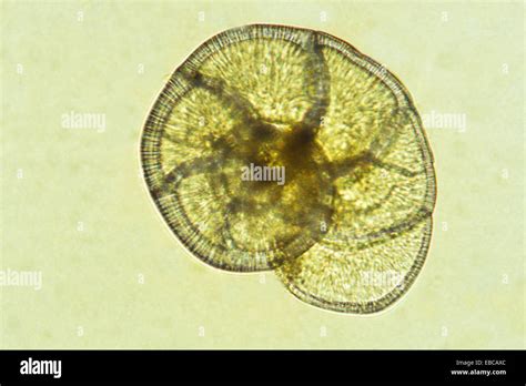 Foram, Foraminifera, 200 X, Protozoa, optical microscope Stock Photo, Royalty Free Image ...