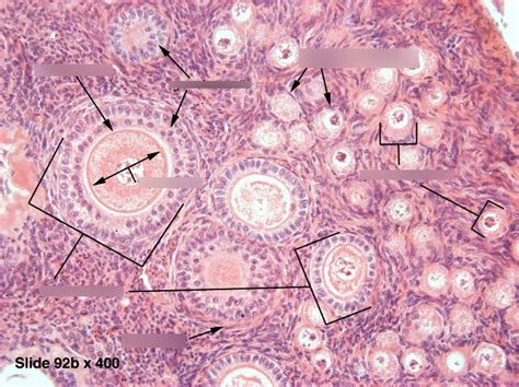 Ovary histology Diagram | Quizlet