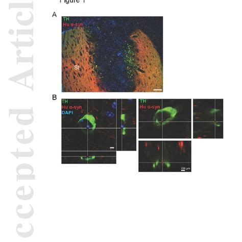 Pathology Propagation In A Model Of α Syn Preformed Fibrils Injection