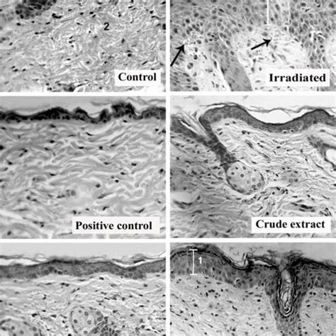 Histopathological Study Control Untreated Skin 1 Normal Epidermis